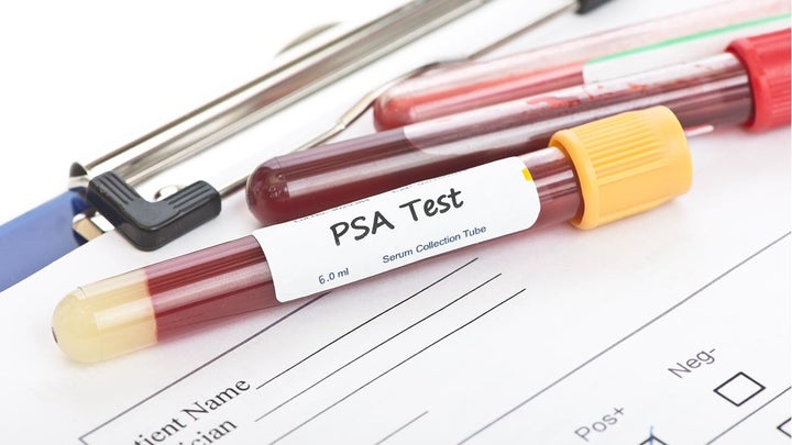 prostate cancer blood test name