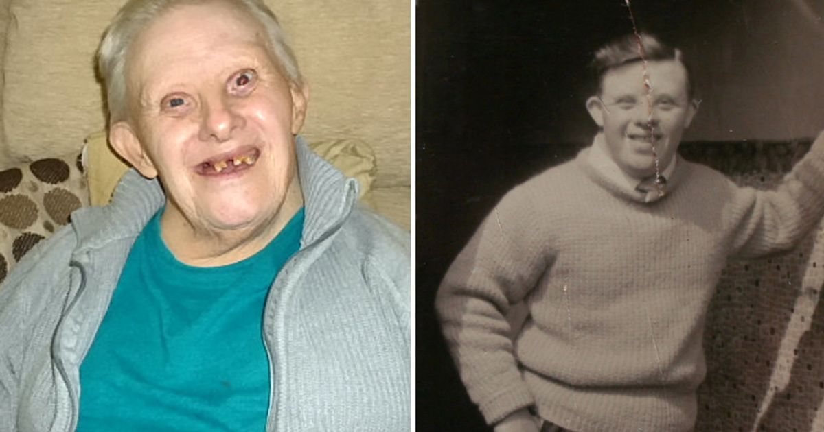 World's Oldest Person With Down's Syndrome Celebrates 77th Birthday
