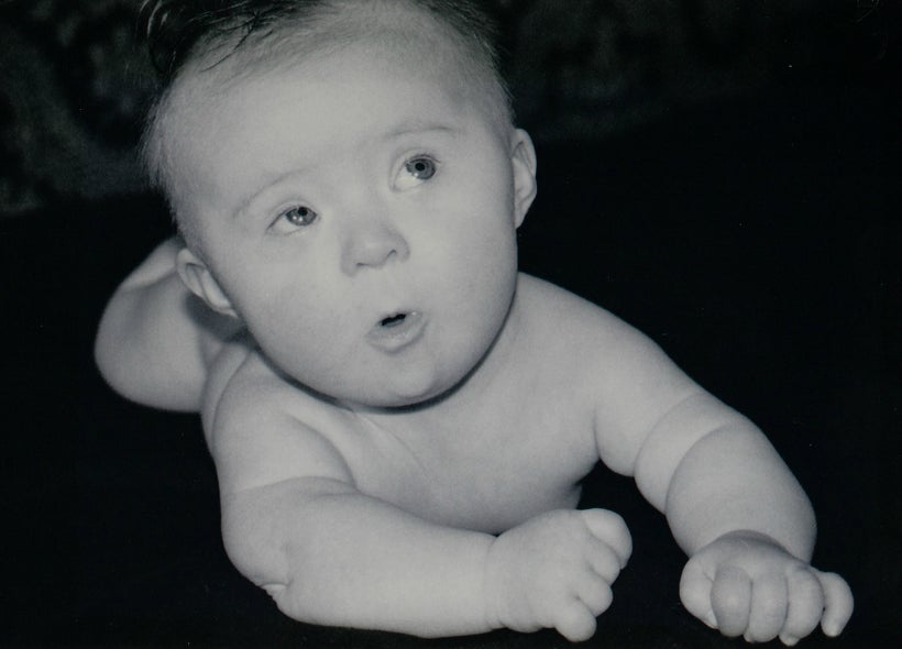 Cute baby with Down syndrome