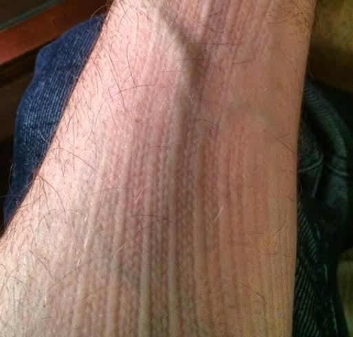 <p>A ribbed sweater leaves an imprint on my arm. It’s not only octopuses that can change the texture of their skin!</p>