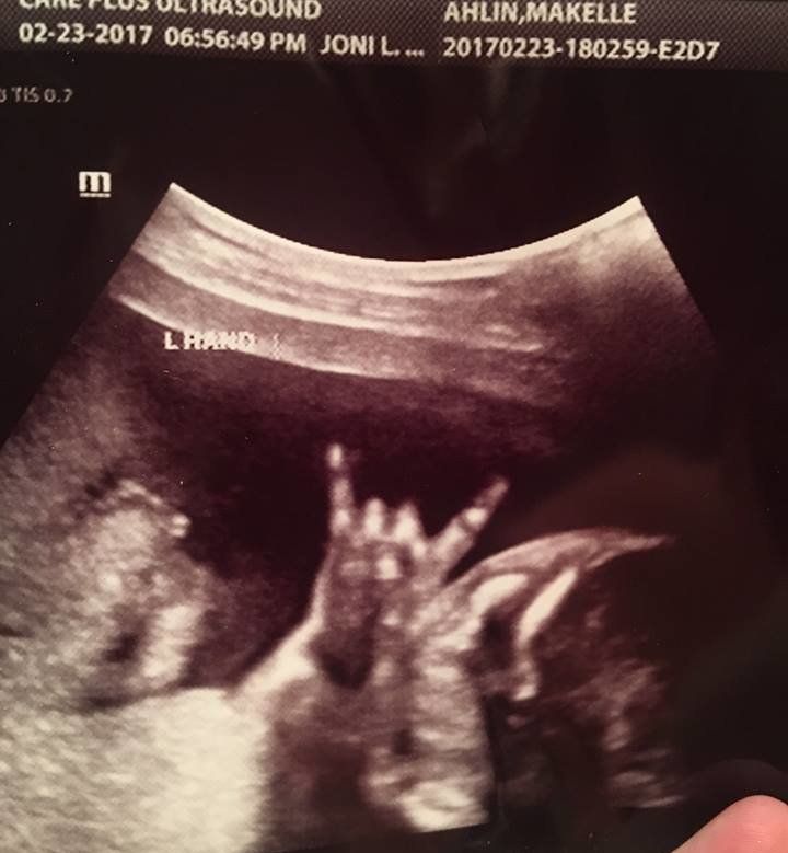 Rock on baby! One expecting couple's sonogram has an unexpected find.