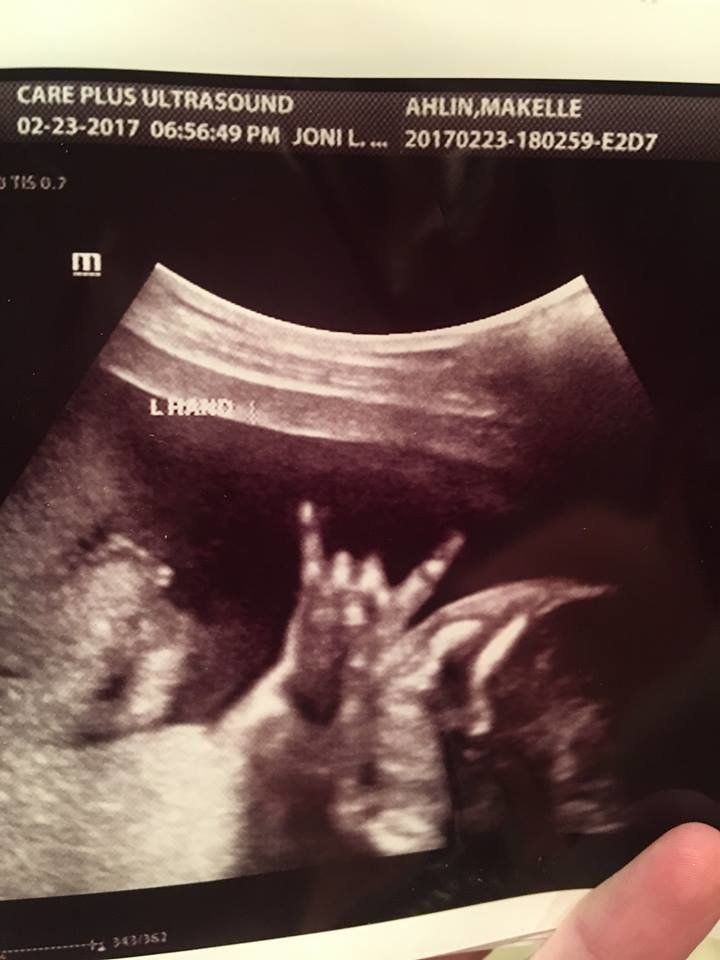 Rock on baby! One expecting couple's sonogram has an unexpected find.