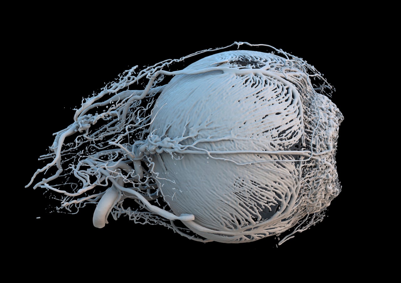 Vessels of a healthy mini-pig eye.