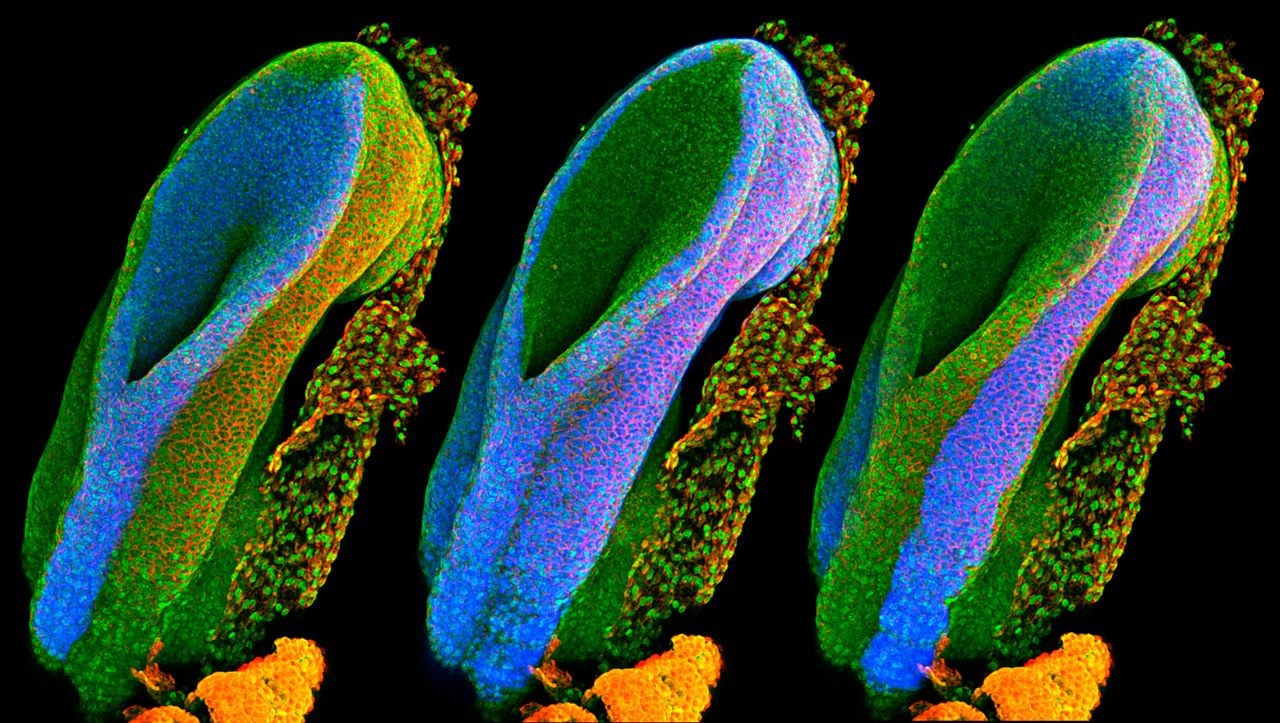 Developing spinal cord: This series of three images shows the open end of a mouse's neural tube. The left neural tube develops into the brain, spine and nerves.