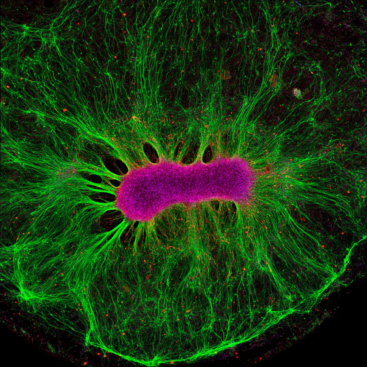 Brain-on-a-chip: Researchers investigate how neural stem cells grow on a synthetic gel called PEG.