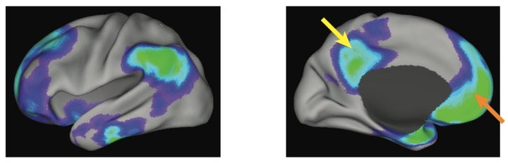 The Default Mode Network.  Blue colors indicate areas of the brain that show less activity when we perform cognitive tasks. These areas constitute the default mode network.