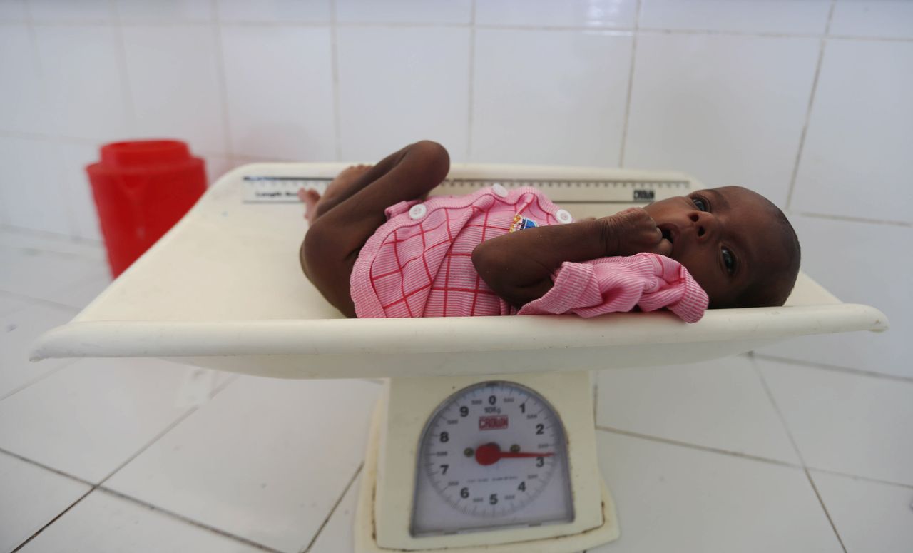 An internally displaced Somali child was screened for malnutrition before receiving treatment inside a ward dedicated to diarrhea patients at the Banadir hospital in Somalia's capital Mogadishu on March 5.