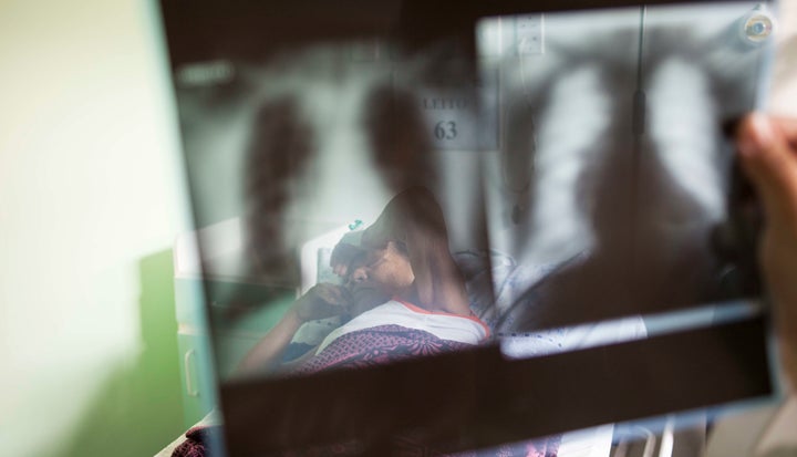 An elderly woman being treated for malaria at Fundacao de Medicina Tropical do Amazonas in Manaus, Brazil.