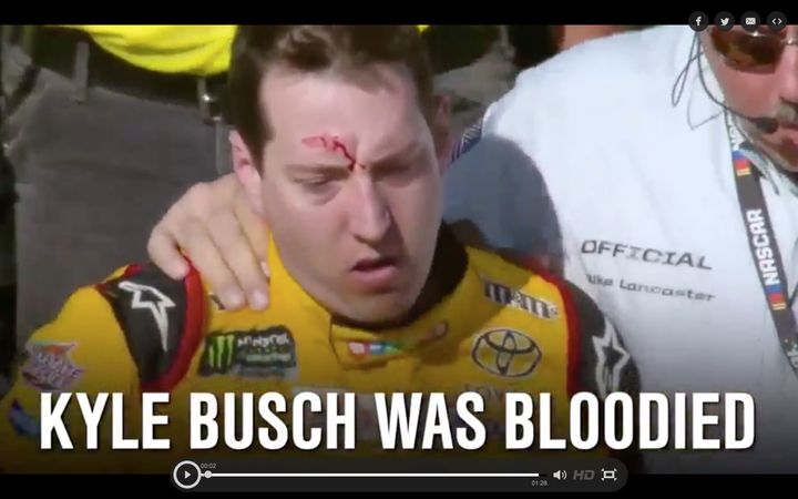 NASCAR driver Kyle Busch was left with a bloody gash on his forehead following a brawl at the Las Vegas Motor Speedway on Sunday.