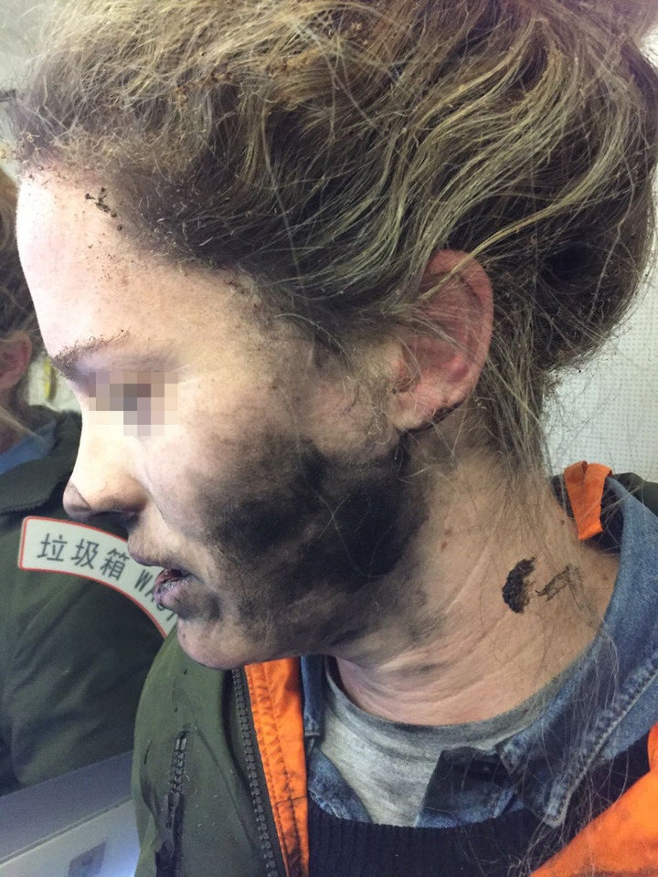 The woman says flight attendants helped her extinguish the fire on the Feb. 19 flight from Beijing, China, to Melbourne, Australia.