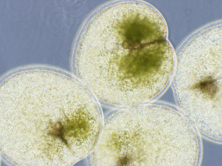 Green Noctiluca blooms in the Arabian Sea and other locations.