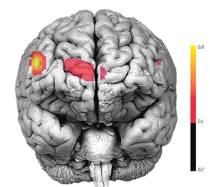 Researchers analyzed brain scans like this one for their latest experiment. The red areas indicate which areas of the brain are most active -- in this case, the prefrontal cortex, which is responsible for executive function related to complex behaviors.