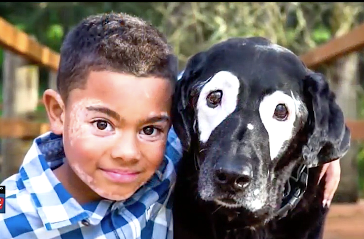 Carter Blanchard, who has the skin disorder vitiligo, has made a friend of Rowdy, a black Labrador retriever with the same condition.