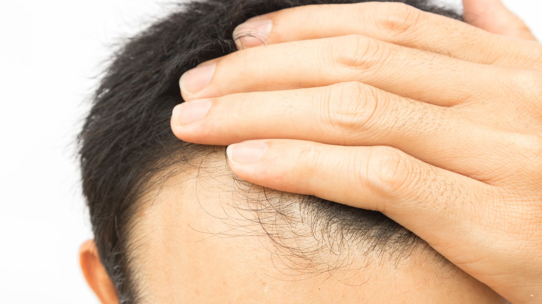 Hair Loss Drugs Linked To Depression And Erectile Dysfunction