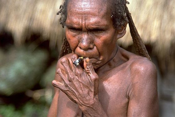 <p>A Dani woman smokes with her amputated fingers.</p>