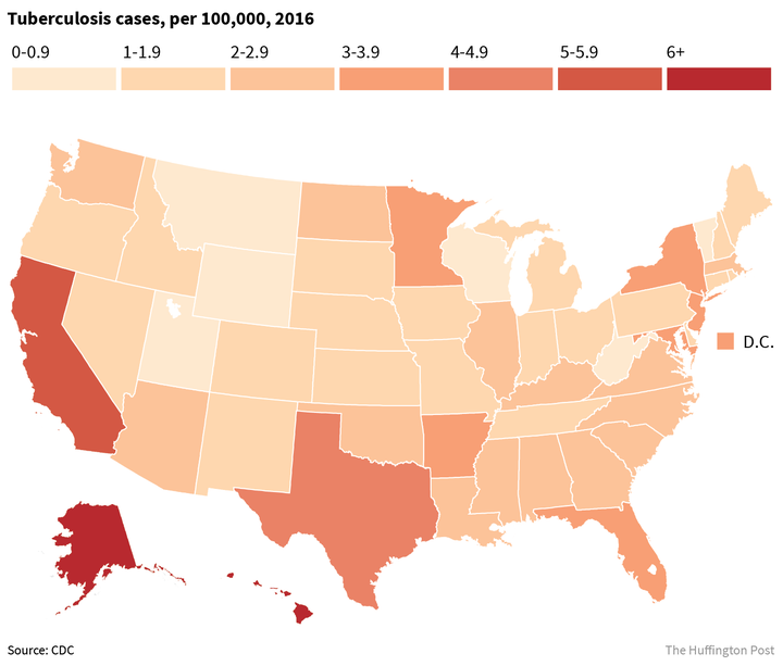 There Are Now Fewer Tuberculosis Cases In The U.S. Than The CDC Has ...