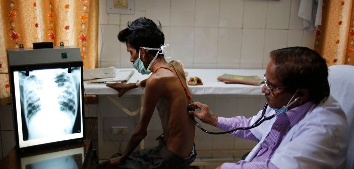 An Indian doctor examines a tuberculosis patient in a government TB hospital.