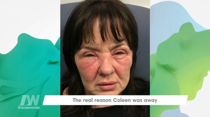 Coleen had a stress-related reaction to the news