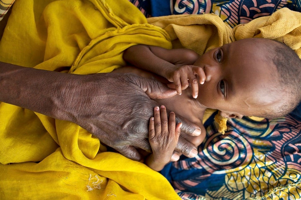 Yafati rests her hand on her great-grandchild, a newborn who is being treated for severe acute malnutrition at an ICU clinic