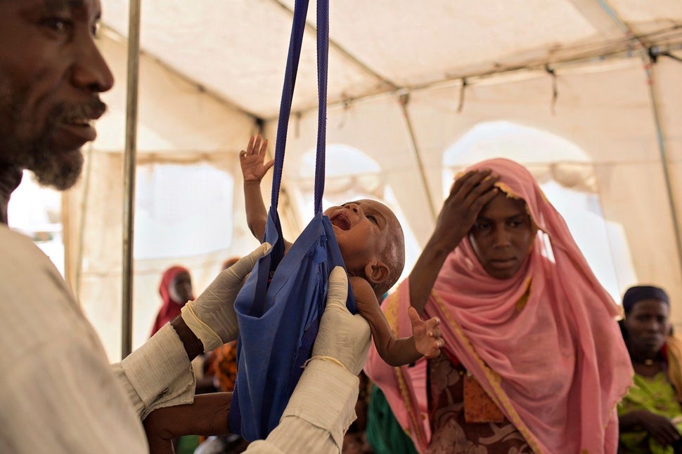 A young child suffering from severe acute malnutrition is weighed at a UNICEF-run clinic in Dikwa, a town formerly occupied b