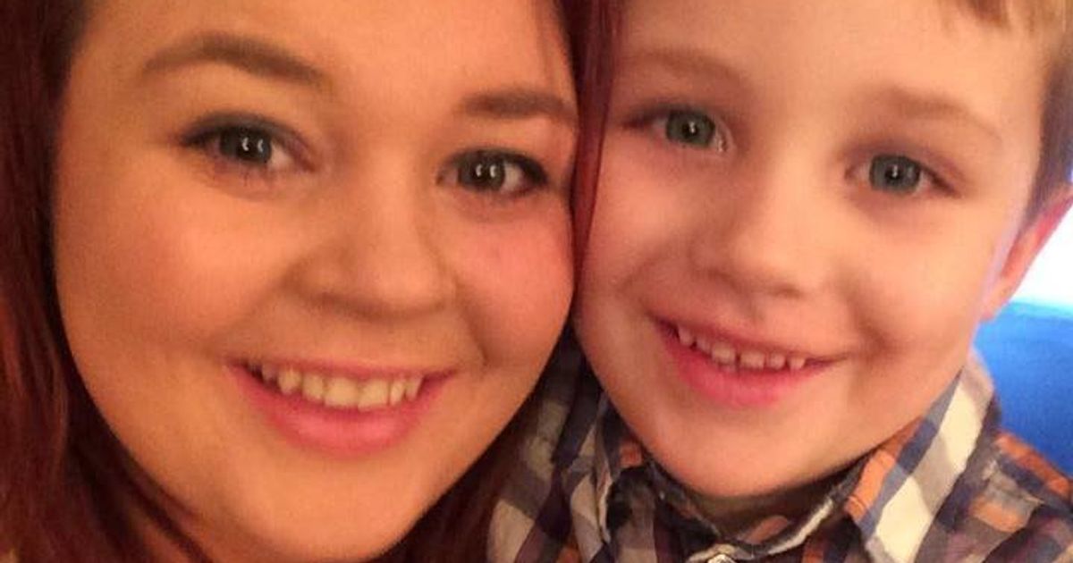 Student Gemma Martin With 'Golf Ball-Sized' Brain Tumour Misdiagnosed ...