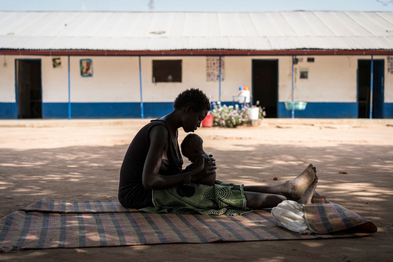 A young mother cradles her malnourished child outside a UNICEF-supported center in South Sudan on March 11.