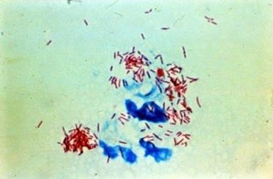 <a rel="nofollow" href="http://idsc.nih.go.jp/about/index-e.html" target="_blank">INFECTIOUS DISEASE SURVEILLANCE CENTER (IDS