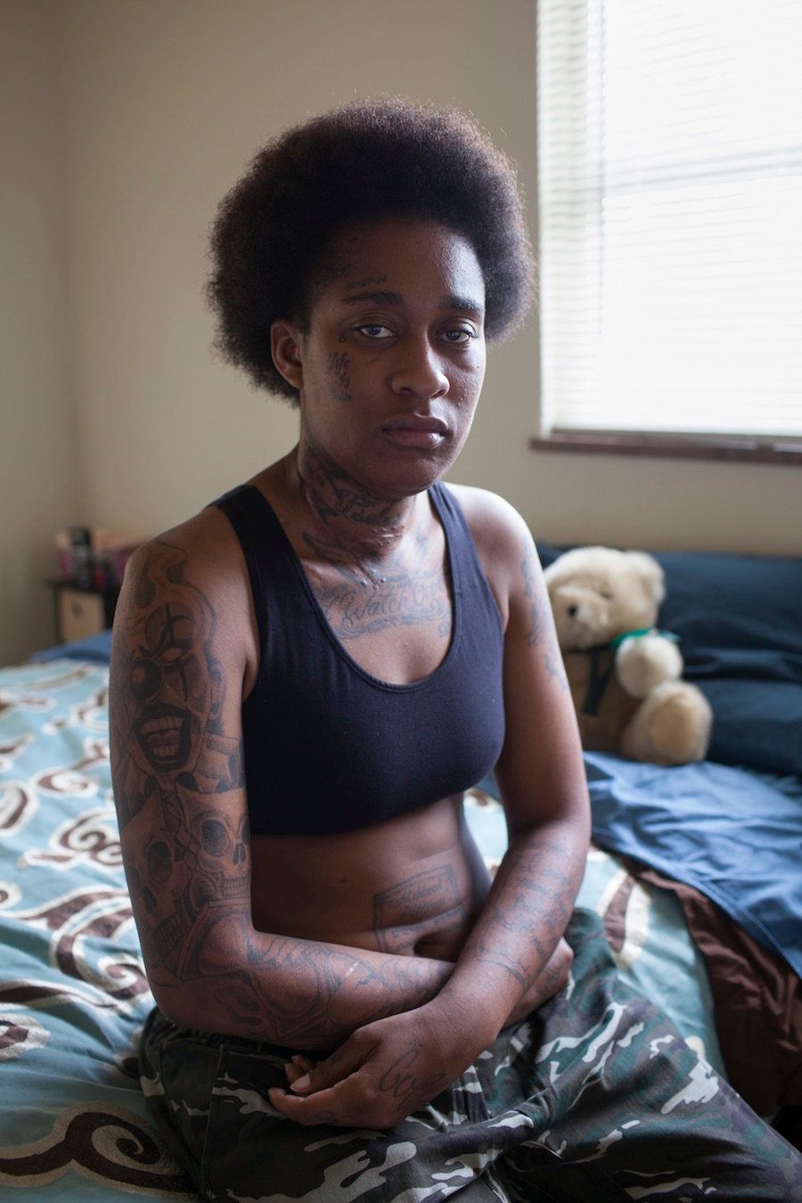 <strong>"Shanessa </strong>was shot by her sister’s boyfriend. A year later, she was shot again, in the face and hand; this time it was by his friends who wanted to stop her from testifying against him." (Newport News, Virginia, 2014 and 2015.)