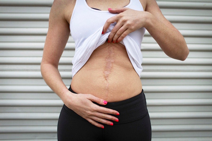"During the Fort Hood shootings, <strong>Dayna </strong>was wounded by a crazed psychiatrist who killed 14 people and injured 32 in the massacre. An Army sergeant and Purple Heart recipient, she was shot three times when the gunman found her hiding behind a table." (Fort Hood, Texas, 2009.)