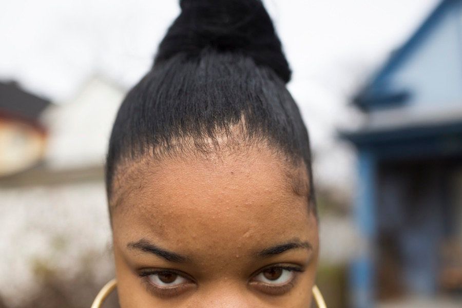 "Seventeen-year-old <strong>Chloe </strong>was talking with friends on the street when a stray bullet hit her in the head." (Kansas City, Missouri, 2013.)