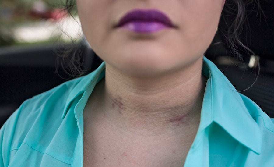 "After leaving her shift at a Holiday Inn around 11:00 pm, <strong>Cori</strong> got in her car to drive home. Headed for the freeway, she stopped at a red light. In the next second Romero was shot in the neck. The shooter then drove off." (Fort Collins, Colorado 2015.)