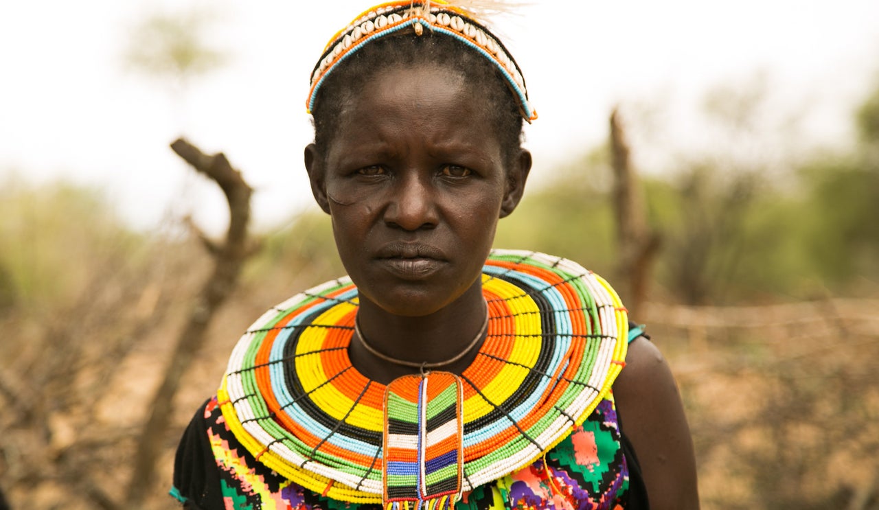 Cheposait Adomo was bitten repeatedly by a black mamba in Kenya's West Pokot. She survived after being taken to a nearby clinic and given anti-venom, which is often unavailable in rural areas.