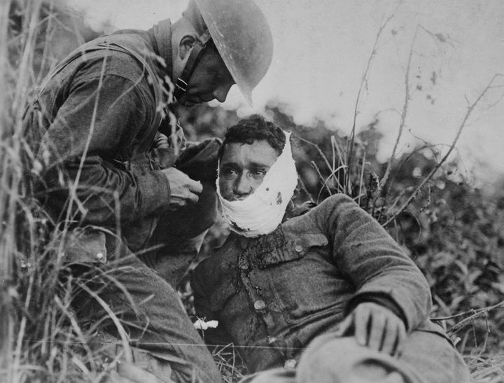 One of the millions of wounded World War I soldiers. 