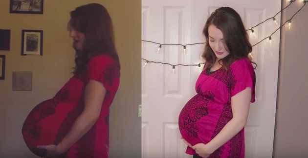 Mum Compares Twin Pregnancy And Current Pregnancy At 36 Weeks In ...