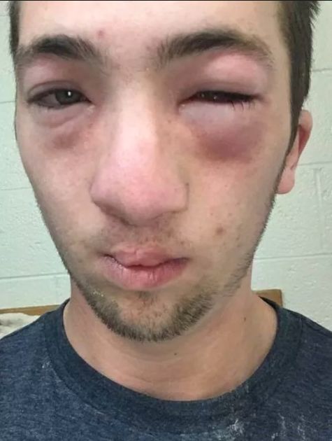 Andrew Seely claims peanut butter was smeared across his face as he slept 