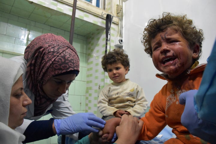 Syrian children, wounded in a suicide car bombing that targeted their buses in Rashidin, west of Aleppo.