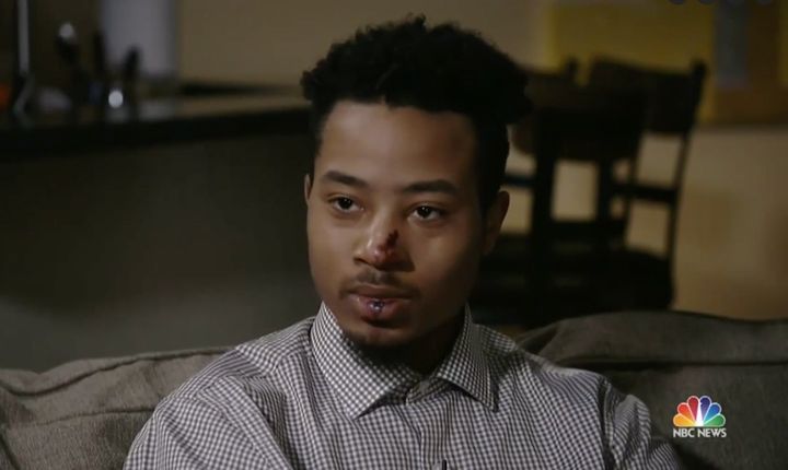 Demetrius Hollins was punched and kicked by two police officers last week. It's all on video.