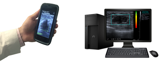 <p>Clearview Diagnostics is tackling cancer diagnosis and the high cost of health care with its ultrasound diagnostic tool.</p>
