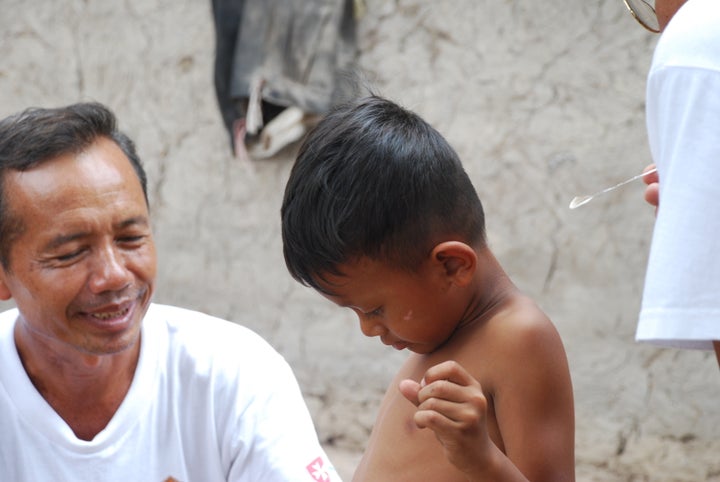 A young boy in Cambodia is screened for leprosy symptoms with the use of a feather.