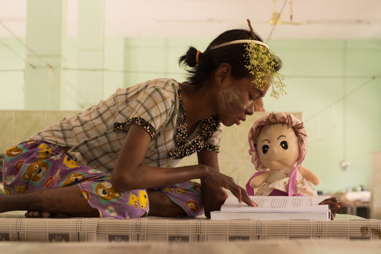 Su Myant Sandar at the Myitta asylum, where she is receiving treatment to cure her leprosy. She smears thanaka, a common cosmetic in Myanmar, on her cheek to cover a lesion that appeared when she was a teen.