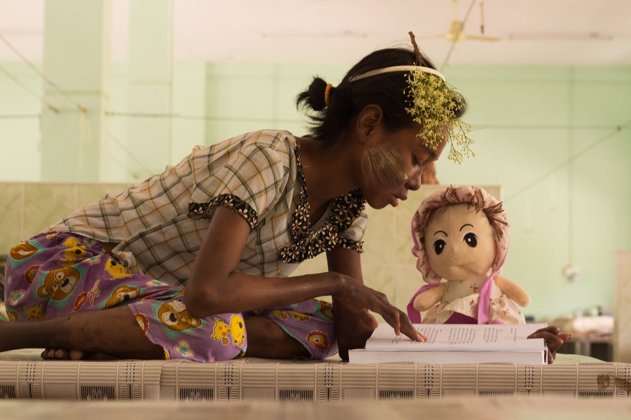 Su Myant Sandar at the Myitta asylum, where she is receiving treatment to cure her leprosy. She smears thanaka, a common cosmetic in Myanmar, on her cheek to cover a lesion that appeared when she was a teen. 