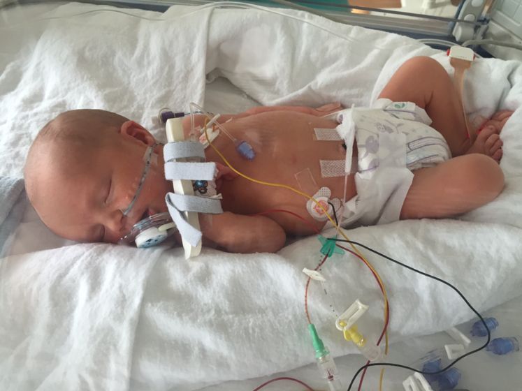 Meningitis Rare But Potentially Fatal HuffPost Life   58fb53cb14000029001b5b94 