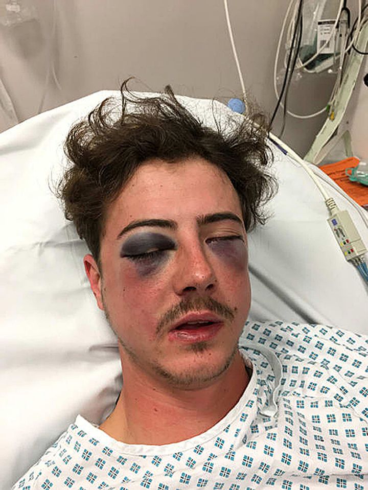 <strong>Tottenham Hotspur fan Michael Voller was left with serious injuries after being mistaken for a Chelsea fan</strong>
