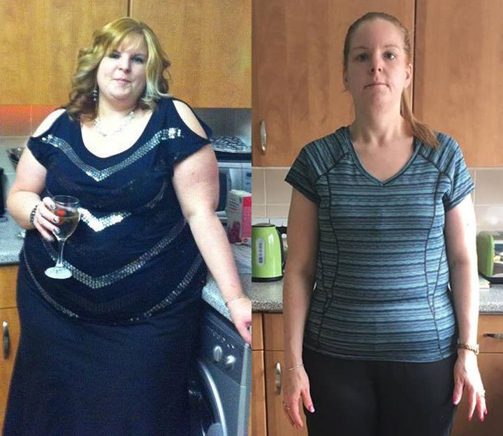 Clare before (left) and after (right) losing weight. 