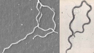 <p>Lyme disease spirochetes (left) and syphilis spirochetes (right)</p>