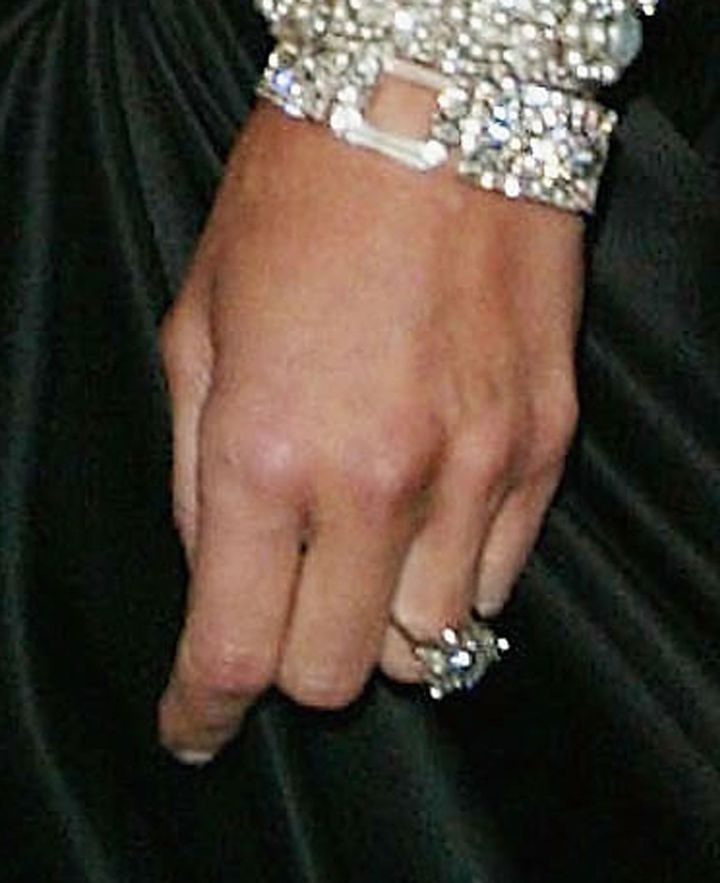 A close-up view of the engagement ring Trump gave to then-girlfriend Melania Knauss at the 'Dangerous Liaisons: Fashion and Furniture in the 18th Century' Costume Institute benefit gala.