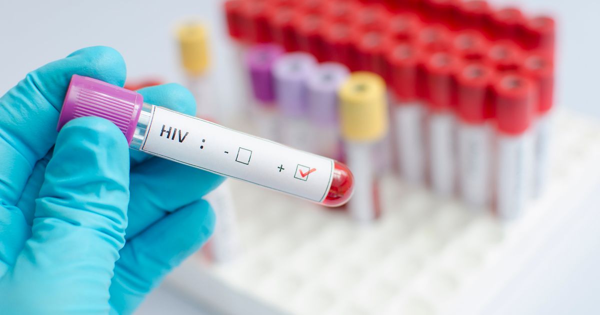 Вич инфицированные тест. ВИЧ. Тест на ВИЧ. Тест на ВИЧ инфекцию. Лабораторная диагностика герпеса.