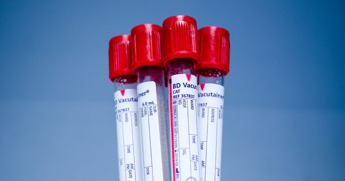 Blood Chemistry: What You Need to Know | HuffPost Contributor