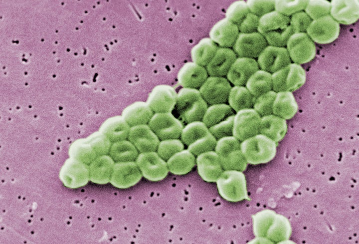 This image from a scanning electron microscope depicts a highly magnified cluster of Gram-negative, non-motile Acinetobacter baumannii bacteria.