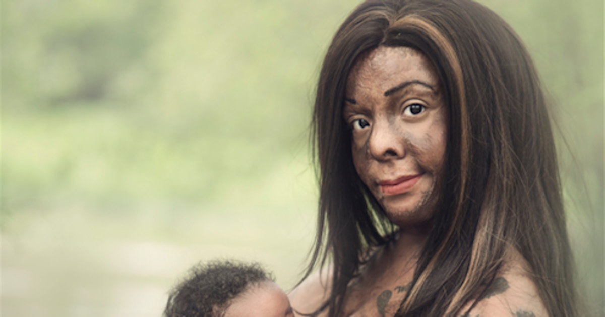 Burn Survivor Poses For Powerful Breastfeeding Photos HuffPost Life